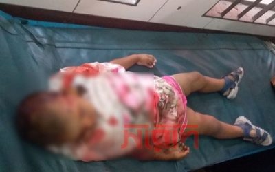 আখাউড়ায় বেপরোয়া ট্রাকের চাপায় খাদে সিএনজি, শিশু নিহত