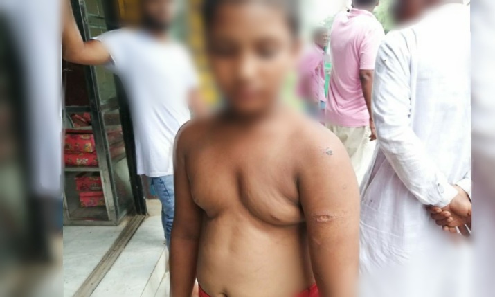 আখাউড়ায় বেকারিতে শিশু শ্রমিক বিস্কুট খাওয়ায় রড দিয়ে নির্যাতন