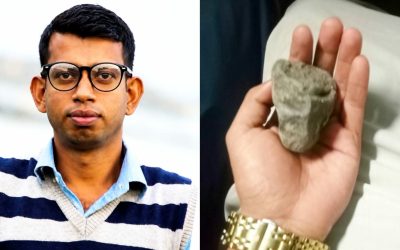 ব্রাহ্মণবাড়িয়ায় চলন্ত ট্রেনে দুর্বৃত্তদের ছোড়া পাথরে চোখ হারালেন আইনজীবী