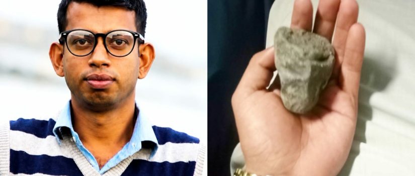 ব্রাহ্মণবাড়িয়ায় চলন্ত ট্রেনে দুর্বৃত্তদের ছোড়া পাথরে চোখ হারালেন আইনজীবী
