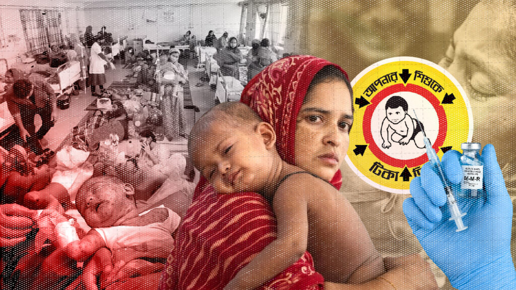 হামের উপসর্গ নিয়ে আরও ৭ শিশুর মৃত্যু